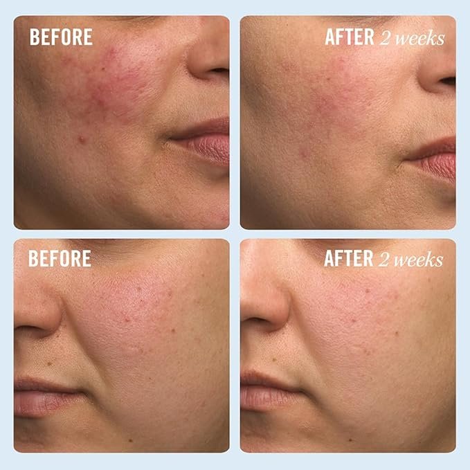 ultra repair cream Before&After